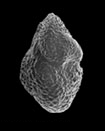 Scanning electron micrograph of a foraminiferan
